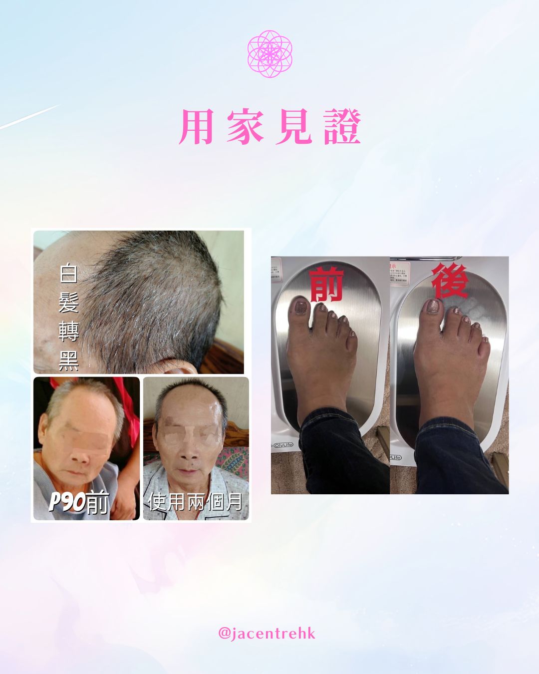 Olylife P90太赫茲兆能儀